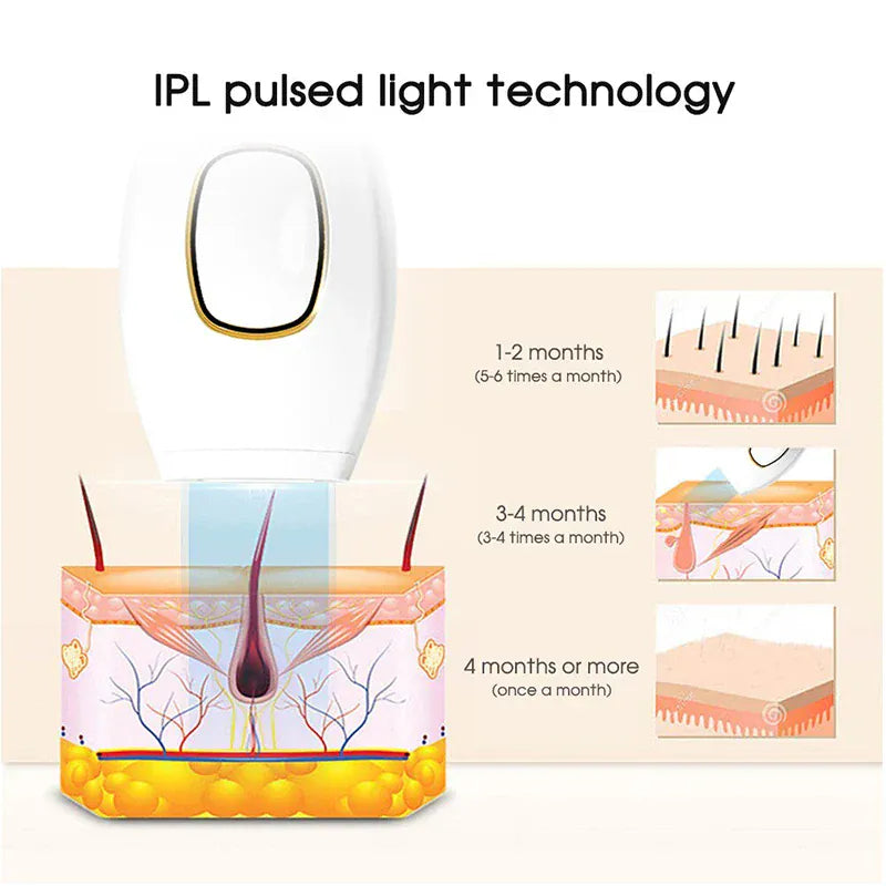 épilateur-laser-IPL